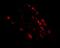 Mex-3 RNA Binding Family Member D antibody, NBP1-77332, Novus Biologicals, Immunocytochemistry image 