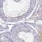 Adhesion G Protein-Coupled Receptor A1 antibody, PA5-60114, Invitrogen Antibodies, Immunohistochemistry frozen image 