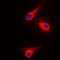 Phospholipase C Gamma 1 antibody, LS-C352668, Lifespan Biosciences, Immunofluorescence image 