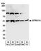 ATPase H+ Transporting V1 Subunit H antibody, A304-308A, Bethyl Labs, Western Blot image 