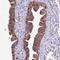 Dynein Cytoplasmic 2 Heavy Chain 1 antibody, PA5-58626, Invitrogen Antibodies, Immunohistochemistry paraffin image 