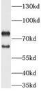 Disintegrin and metalloproteinase domain-containing protein 28 antibody, FNab00142, FineTest, Western Blot image 