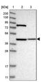 Dehydrogenase/Reductase 13 antibody, PA5-54657, Invitrogen Antibodies, Western Blot image 