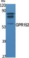 Probable G-protein coupled receptor 152 antibody, A16638, Boster Biological Technology, Western Blot image 