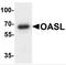 2'-5'-Oligoadenylate Synthetase Like antibody, TA349046, Origene, Western Blot image 