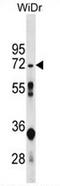 5'-Nucleotidase, Cytosolic II antibody, AP52948PU-N, Origene, Western Blot image 