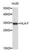 Major Histocompatibility Complex, Class I, F antibody, STJ24030, St John