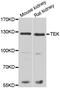 TEK Receptor Tyrosine Kinase antibody, abx005452, Abbexa, Western Blot image 