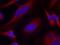 Protein Kinase D1 antibody, GTX50472, GeneTex, Immunofluorescence image 