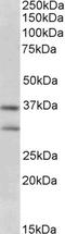 Fibroblast growth factor 23 antibody, STJ71073, St John