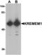 Kringle Containing Transmembrane Protein 1 antibody, orb314180, Biorbyt, Western Blot image 