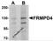 Transmembrane Protein 94 antibody, 5459, ProSci Inc, Western Blot image 