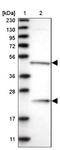 Guanine Deaminase antibody, NBP1-87454, Novus Biologicals, Western Blot image 