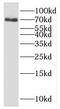 Kelch repeat and BTB domain-containing protein 5 antibody, FNab04476, FineTest, Western Blot image 