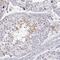 NUT Midline Carcinoma Family Member 1 antibody, PA5-59171, Invitrogen Antibodies, Immunohistochemistry frozen image 