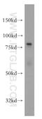 Phosphofructokinase, Liver Type antibody, 15652-1-AP, Proteintech Group, Western Blot image 