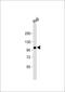 Vav Guanine Nucleotide Exchange Factor 1 antibody, M00691, Boster Biological Technology, Western Blot image 
