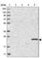 Homeobox protein DLX-6 antibody, PA5-56522, Invitrogen Antibodies, Western Blot image 