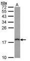 Prefoldin Subunit 5 antibody, TA307930, Origene, Western Blot image 