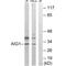 Androgen Induced 1 antibody, A11235, Boster Biological Technology, Western Blot image 