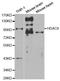 Histone Deacetylase 9 antibody, LS-C331507, Lifespan Biosciences, Western Blot image 