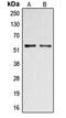DOK2 antibody, MBS820311, MyBioSource, Western Blot image 