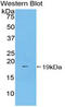 Coagulation Factor II, Thrombin antibody, LS-C302881, Lifespan Biosciences, Western Blot image 