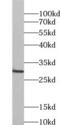 Glycoprotein M6A antibody, FNab03584, FineTest, Western Blot image 