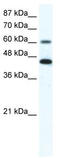 Protein III antibody, TA341652, Origene, Western Blot image 