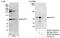 RecQ Mediated Genome Instability 1 antibody, NB100-1720, Novus Biologicals, Western Blot image 