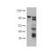 Cadherin 5 antibody, TA320306, Origene, Western Blot image 