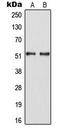 HNF-4-alpha antibody, LS-C354006, Lifespan Biosciences, Western Blot image 