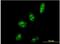Proline, Glutamate And Leucine Rich Protein 1 antibody, H00027043-M06-100ug, Novus Biologicals, Immunocytochemistry image 