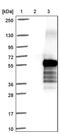 Migration And Invasion Inhibitory Protein antibody, PA5-60869, Invitrogen Antibodies, Western Blot image 