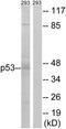 p53 antibody, TA326092, Origene, Western Blot image 