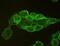 Endonuclease, Poly(U) Specific antibody, 32-201, ProSci, Immunofluorescence image 