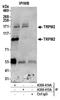 Transient Receptor Potential Cation Channel Subfamily M Member 2 antibody, A300-414A, Bethyl Labs, Immunoprecipitation image 