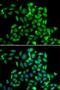 Cytoplasmic Linker Associated Protein 1 antibody, PA5-77125, Invitrogen Antibodies, Immunofluorescence image 