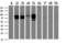 Catenin Beta 1 antibody, LS-C785627, Lifespan Biosciences, Western Blot image 