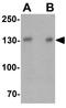 PTPRF Interacting Protein Alpha 3 antibody, GTX32124, GeneTex, Western Blot image 