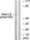 Serine/threonine-protein kinase PAK 1 antibody, PA5-37675, Invitrogen Antibodies, Western Blot image 