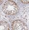 Exosome Component 8 antibody, FNab02907, FineTest, Immunohistochemistry frozen image 