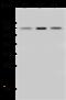 Succinate Dehydrogenase Complex Flavoprotein Subunit A antibody, GTX02249, GeneTex, Western Blot image 