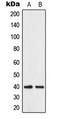 Abhydrolase Domain Containing 12B antibody, LS-C354218, Lifespan Biosciences, Western Blot image 