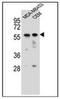 Forkhead Box D4 antibody, AP51705PU-N, Origene, Western Blot image 