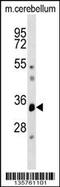 Dual Specificity Phosphatase 12 antibody, 58-792, ProSci, Western Blot image 