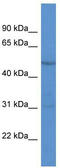 Retinoic Acid Receptor Gamma antibody, TA336211, Origene, Western Blot image 