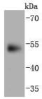 Paired Box 6 antibody, A00273, Boster Biological Technology, Western Blot image 