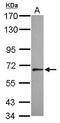 SLIT and NTRK-like protein 1 antibody, GTX118596, GeneTex, Western Blot image 
