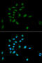Proteasome Subunit Alpha 1 antibody, 18-687, ProSci, Immunofluorescence image 